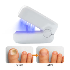 Nail Fungus Remover Laser Treatment LED Light Device Toenail Fungus Treatment